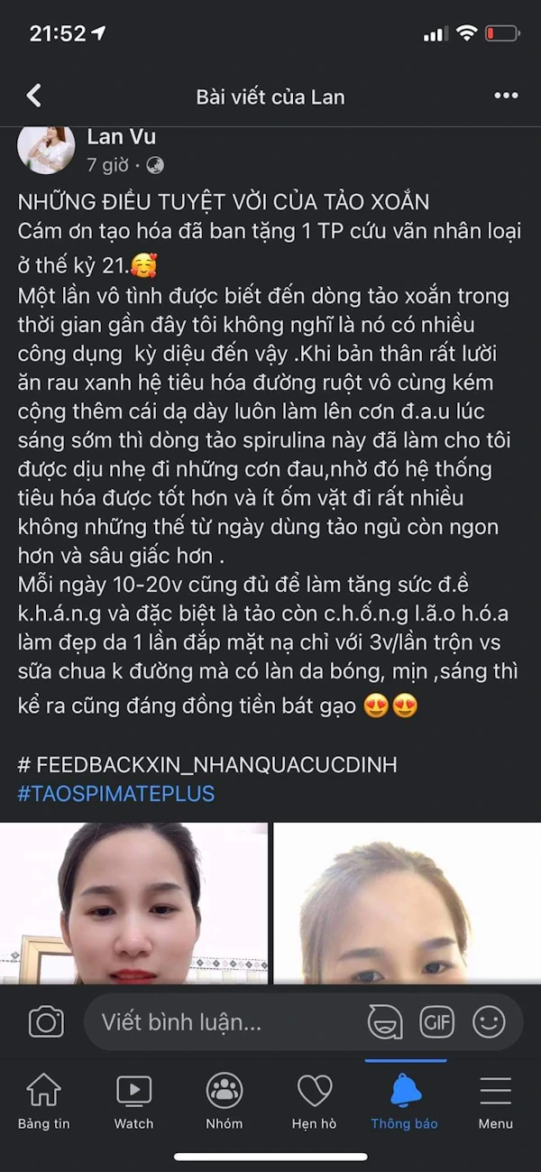 Review Tảo Spirulina Spimate Plus Nhật Bản - Giảm đau Dạ Dày, ít ốm Vặt Hơn, Ngủ Ngon Và Sâu Hơn, đẹp Da, Dùng đắp Mặt Rất Hiệu Quả