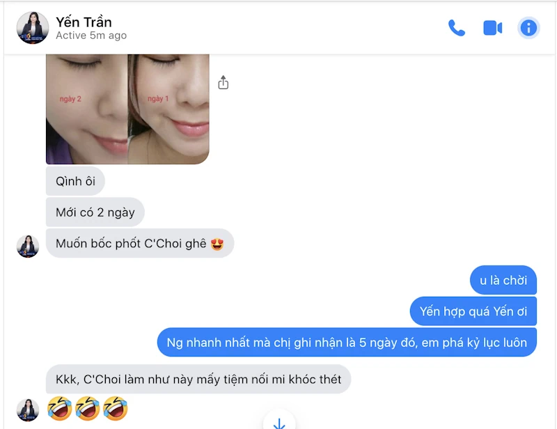 Review Dưỡng Mi Tế Bào Gốc C'choi - Bio-placenta Lash Serum - Punar - 1Mall.vn - Hình 10