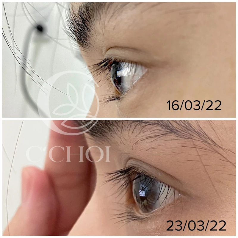 Review Dưỡng Mi Tế Bào Gốc C'choi - Bio-placenta Lash Serum - Punar - 1Mall.vn - Hình 12