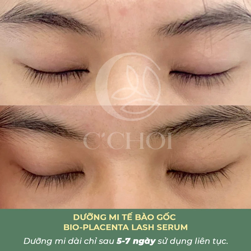 Review Dưỡng Mi Tế Bào Gốc C'choi - Bio-placenta Lash Serum - Punar - 1Mall.vn - Hình 13