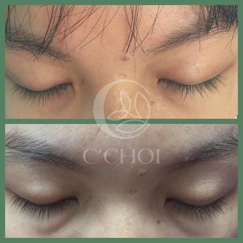 Review Dưỡng Mi Tế Bào Gốc C'choi - Bio-placenta Lash Serum - Punar - 1Mall.vn - Hình 15