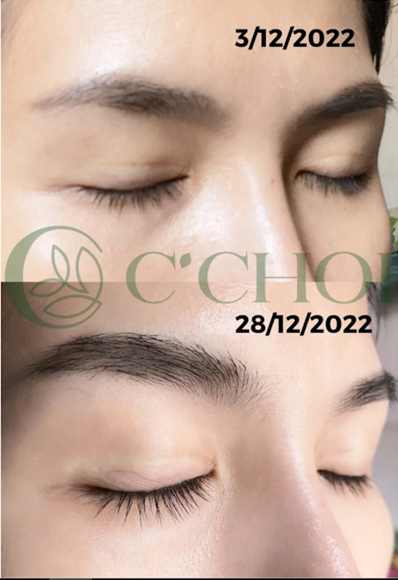 Review Dưỡng Mi Tế Bào Gốc C'choi - Bio-placenta Lash Serum - Punar - 1Mall.vn - Hình 3