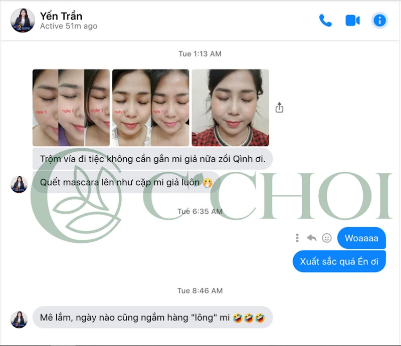 Review Dưỡng Mi Tế Bào Gốc C'choi - Bio-placenta Lash Serum - Punar - 1Mall.vn - Hình 6