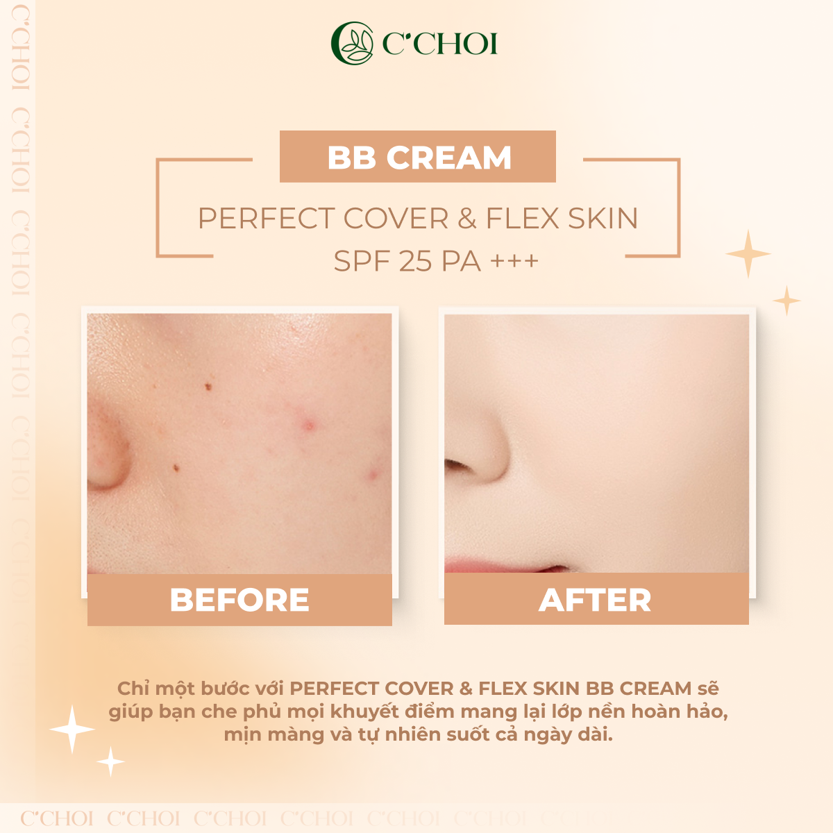 Che Phủ Mọi Khuyết điểm Với Kem Nền Che Khuyết Điểm C'choi - Perfect Cover & Flex Skin Bb Cream